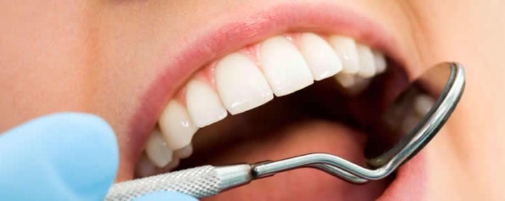 Cure Conservative ed Endodontiche