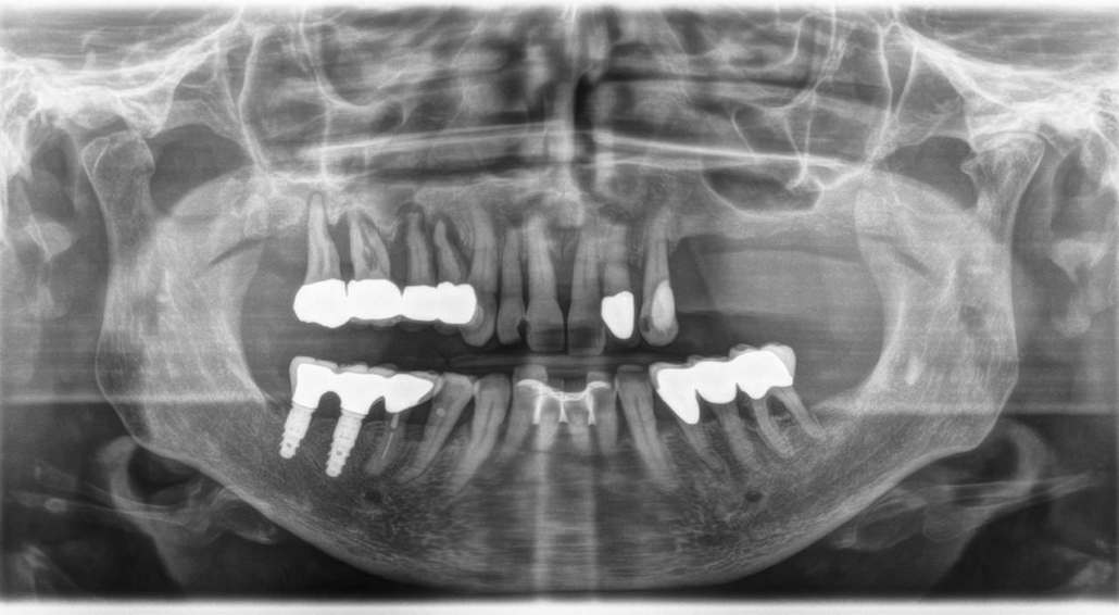 Diagnosi Radiologica