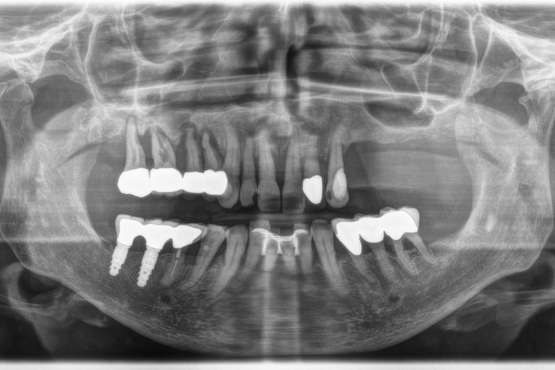 Diagnosi Radiologica