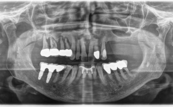 Diagnosi Radiologica