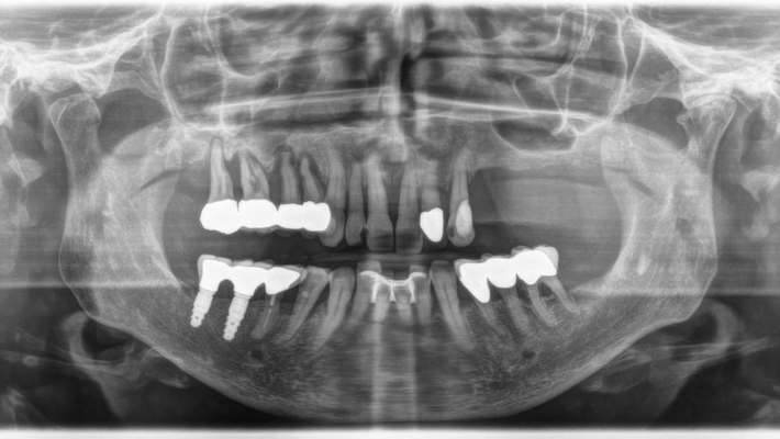Diagnosi Radiologica